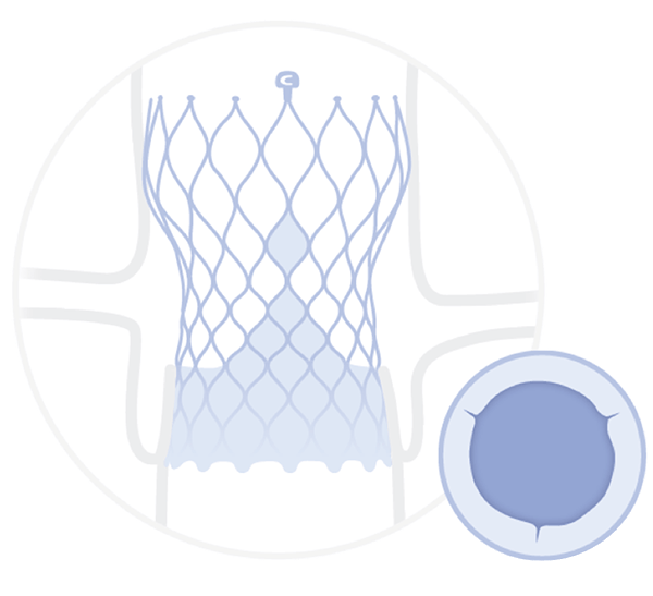 Diagram Evolut TAVR System