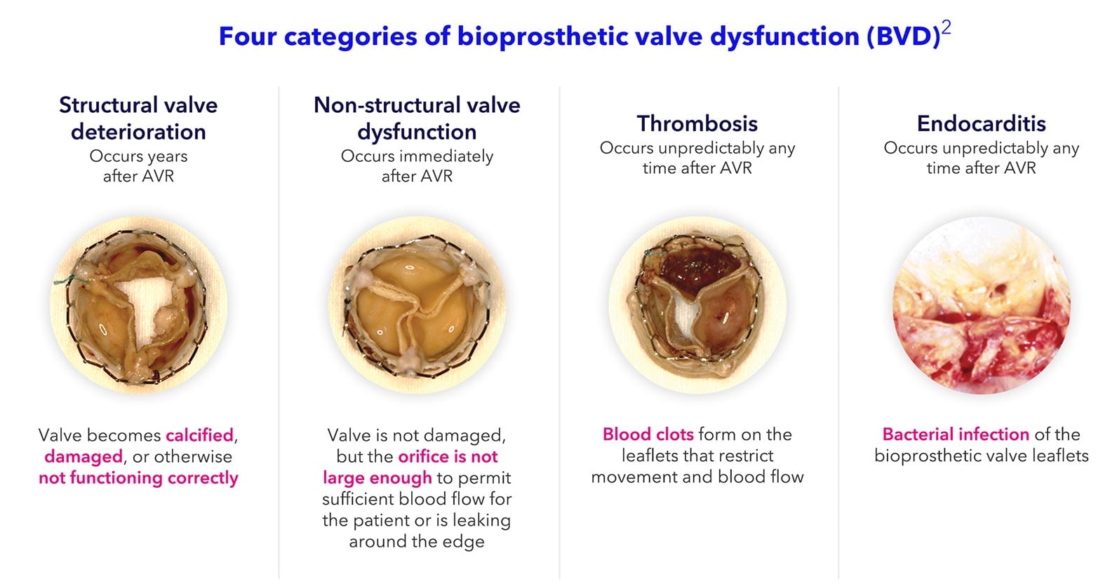 Poor valve performance results in worse patient outcomes