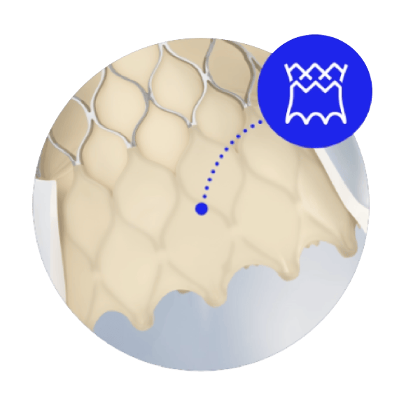 External tissue wrap image