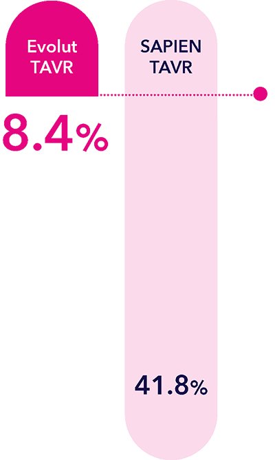 BVD in women vs. SAPIEN™ platform bar graph