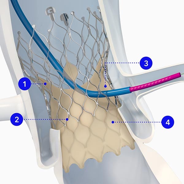 Evolut™ TAVR differentiated design that matters for your patient