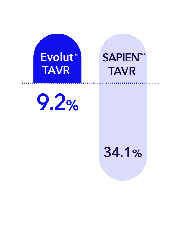 Smart trial PPM chart